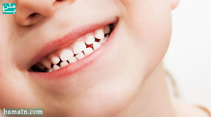 نگهداری دندان کودکان و دندان شیری و دائمی کودک
